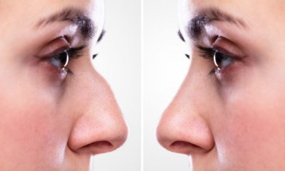 nose-youve-always-wanted-exploring-the-transformative-benefits-of-rhinoplasty